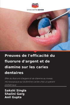 Paperback Preuves de l'efficacité du fluorure d'argent et de diamine sur les caries dentaires [French] Book