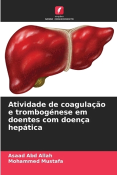 Paperback Atividade de coagulação e trombogénese em doentes com doença hepática [Portuguese] Book