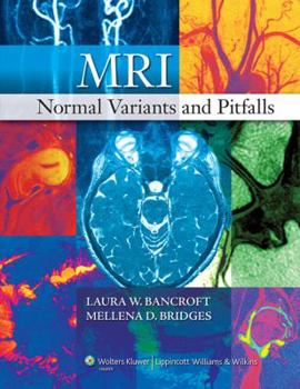 Hardcover MRI Normal Variants and Pitfalls Book