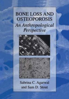 Hardcover Bone Loss and Osteoporosis: An Anthropological Perspective Book