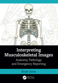 Paperback Interpreting Musculoskeletal Images: Anatomy, Pathology and Emergency Reporting Book