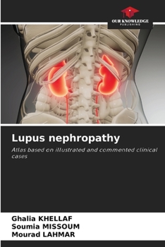 Paperback Lupus nephropathy Book