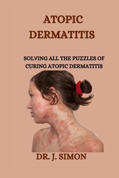 Paperback Atopic Dermatitis: Solving All the Puzzles of Curing Atopic Dermatitis Book