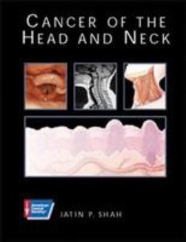 Hardcover Cancer of the Head and Neck Book