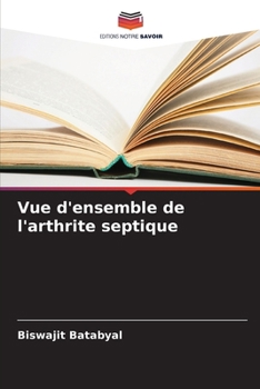 Paperback Vue d'ensemble de l'arthrite septique [French] Book