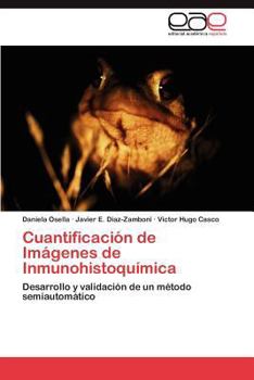 Paperback Cuantificacion de Imagenes de Inmunohistoquimica [Spanish] Book