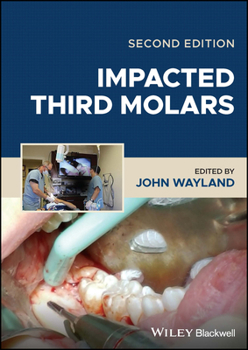 Hardcover Impacted Third Molars Book