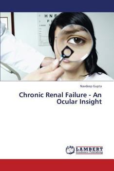 Paperback Chronic Renal Failure - An Ocular Insight Book