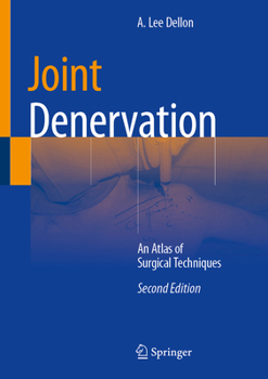 Hardcover Joint Denervation: An Atlas of Surgical Techniques Book