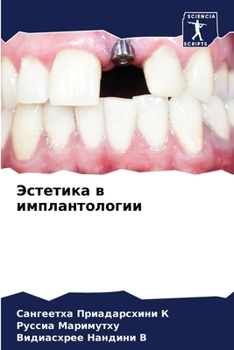 Paperback Эстетика в имплантологи& [Russian] Book