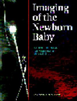 Hardcover Imaging of The Newborn Baby Book