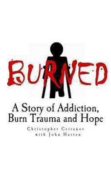 Paperback Burned: A Survivors Journey Book