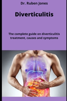 Diverticulitis: The complete guide on diverticulitis treatment, causes and symptoms