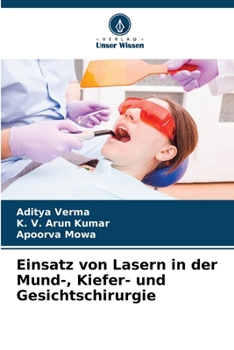 Paperback Einsatz von Lasern in der Mund-, Kiefer- und Gesichtschirurgie [German] Book