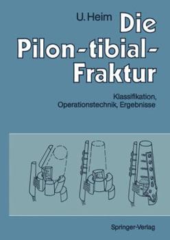 Paperback Die Pilon-Tibial-Fraktur: Klassifikation, Operationstechnik, Ergebnisse [German] Book