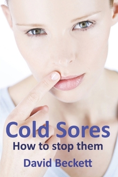 Paperback Cold Sores: How to stop them Book