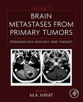 Hardcover Brain Metastases from Primary Tumors Volume 1: Epidemiology, Biology, and Therapy Book
