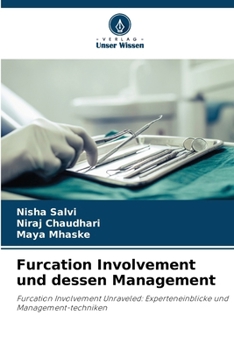 Paperback Furcation Involvement und dessen Management [German] Book
