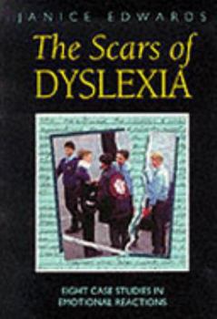 Paperback The Scars of Dyslexia: Eight Case Studies in Emotional Reactions (Cassell Education) Book