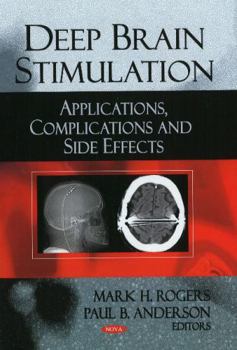 Hardcover Deep Brain Stimulation: Applications, Complications and Side Effects Book