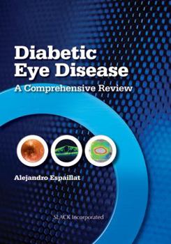 Hardcover Diabetic Eye Disease: A Comprehensive Review Book