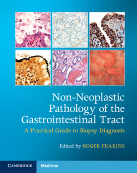 Hardcover Non-Neoplastic Pathology of the Gastrointestinal Tract with Online Resource: A Practical Guide to Biopsy Diagnosis [With Access Code] Book