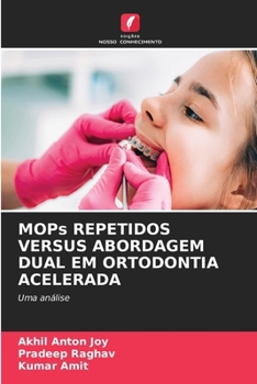 Paperback MOPs REPETIDOS VERSUS ABORDAGEM DUAL EM ORTODONTIA ACELERADA [Portuguese] Book