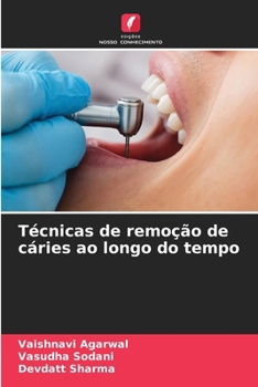 Paperback Técnicas de remoção de cáries ao longo do tempo [Portuguese] Book