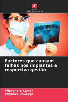 Paperback Factores que causam falhas nos implantes e respectiva gestão [Portuguese] Book