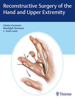 Hardcover Reconstructive Surgery of the Hand and Upper Extremity Book