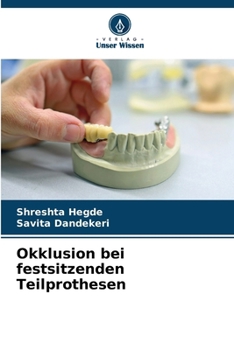 Paperback Okklusion bei festsitzenden Teilprothesen [German] Book