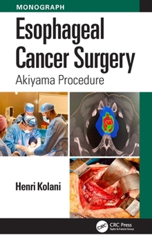 Paperback Esophageal Cancer Surgery: Akiyama Procedure Book