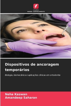 Dispositivos de ancoragem temporários (Portuguese Edition)