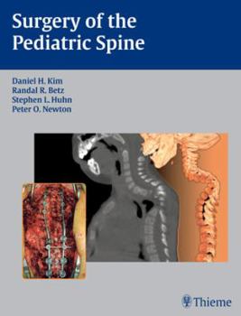 Hardcover Surgery of the Pediatric Spine Book