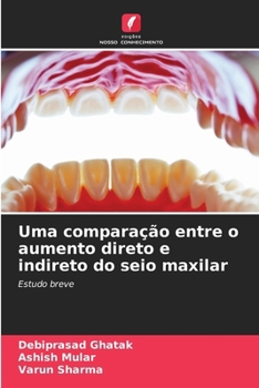 Paperback Uma comparação entre o aumento direto e indireto do seio maxilar [Portuguese] Book