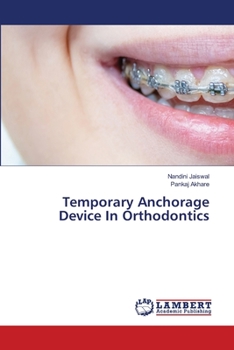 Paperback Temporary Anchorage Device In Orthodontics Book