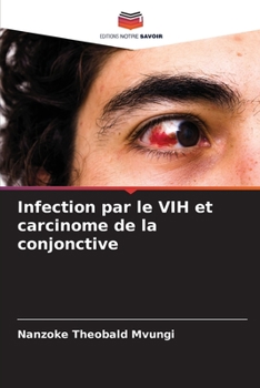 Paperback Infection par le VIH et carcinome de la conjonctive [French] Book