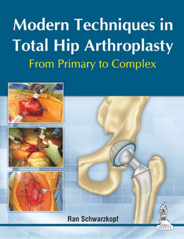 Hardcover Modern Techniques in Total Hip Arthroplasty: From Primary to Complex Book