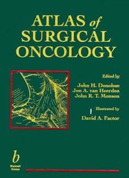 Hardcover Atlas of Surgical Oncology Book