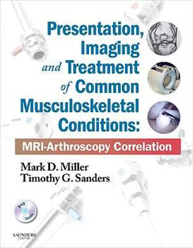Hardcover Presentation, Imaging and Treatment of Common Musculoskeletal Conditions: Mri-Arthroscopy Correlation (Expert Consult - Online and Print) [With DVD] Book