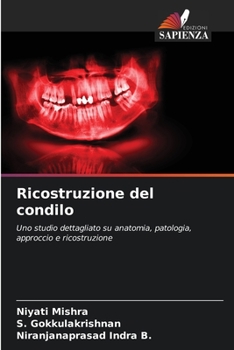 Paperback Ricostruzione del condilo [Italian] Book