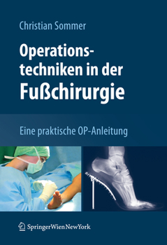 Hardcover Operationstechniken in Der Fußchirurgie: Eine Praktische Op-Anleitung [German] Book