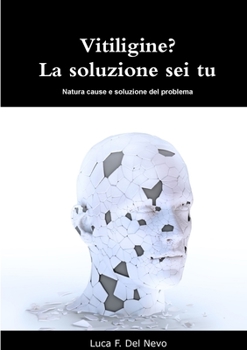 Paperback Vitiligine? La soluzione sei tu [Italian] Book