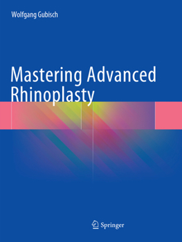 Paperback Mastering Advanced Rhinoplasty Book
