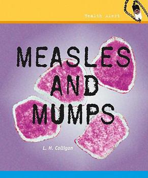 Library Binding Measles and Mumps Book