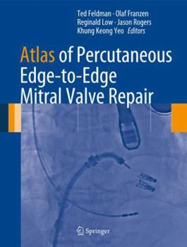 Hardcover Atlas of Percutaneous Edge-To-Edge Mitral Valve Repair Book