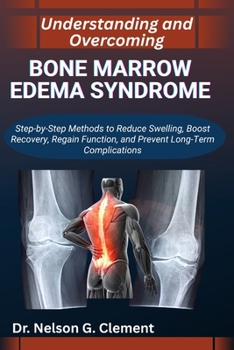 Paperback Understanding and Overcoming Bone Marrow Edema Syndrome: Step-by-Step Methods to Reduce Swelling, Boost Recovery, Regain Function, and Prevent Long-Te Book