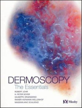 Paperback Dermoscopy: The Essentials Book