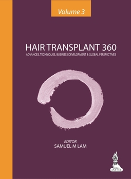 Hardcover Hair Transplant 360, Vol 3: Advances, Techniques, Business Development & Global Perspectives Book