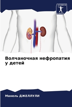 Paperback Волчаночная нефропатия & [Russian] Book